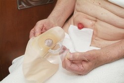 Tesne pred nasadením vrecka z neho odstráňte ochrannú fóliu.