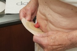 Vrecko začnite nalepovať od dolnej polovice a tesne pod stómiou.