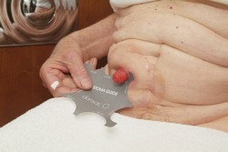 V prípade potreby odmerajte veľkosť vašej stómie pomocou šablóny.