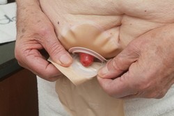 Pripevnite vrecko k podložke.