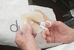 Ak je vaša stómia nerovná či oválna, prispôsobte otvor v podložke na požadovanú veľkosť malými ostrými nožnicami, alebo použite končeky prstov na vyrovnanie otvoru. Zapamätajte si, že je dôležité, aby veľkosť otvoru zodpovedala vašej stómii, a to bez použitia tlaku.