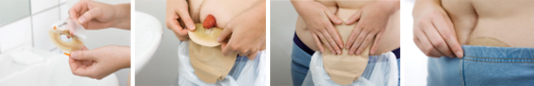 Nalepenie nového vrecka