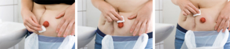 Starostlivosť o pokožku