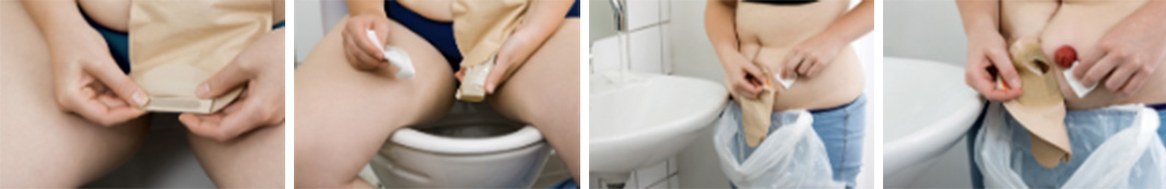 Vyprázdnenie a odstránenie vrecka