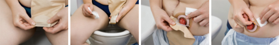 Vyprázdnenie a odstránenie vrecka