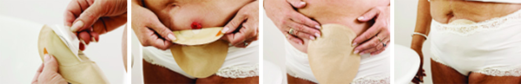 Nalepenie nového vrecka