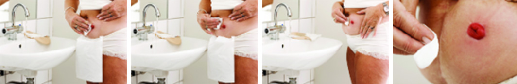 Starostlivosť o pokožku